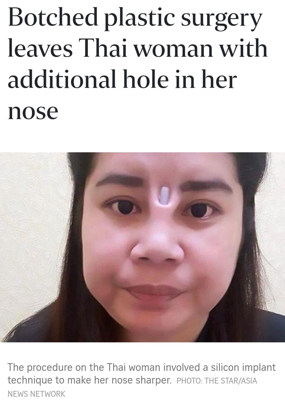 x6j5Nl.jpg
